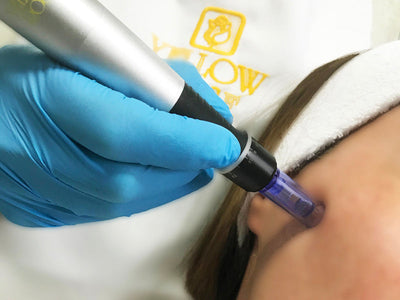 Yellow Rose Microneedling, 45 min i Baska Voda, Croatia